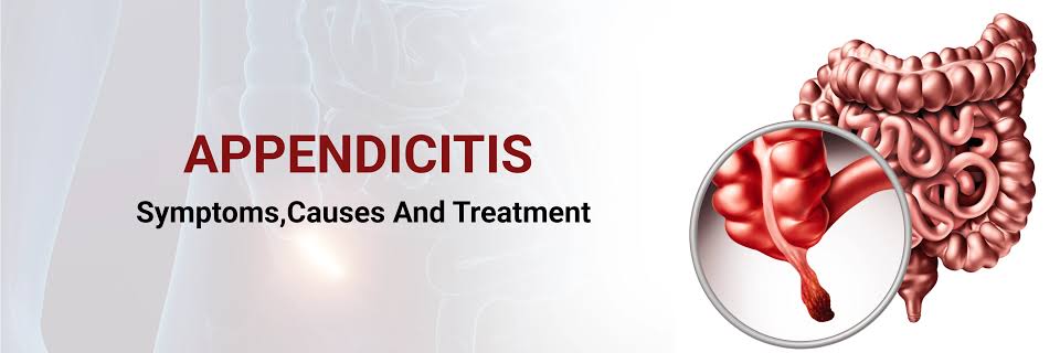 appendicitis-symptoms-causes-and-treatments